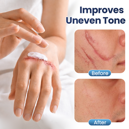 🔥Limited-time 60% sale--Juxek® Texture Repair Gel — Say Goodbye to Stubborn Scars & Uneven Texture in 4 Weeks